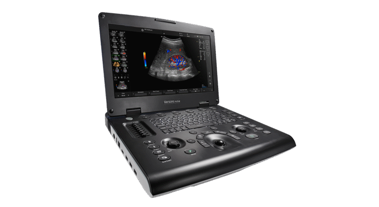 GE Versana Active Portable Ultrasound Machine