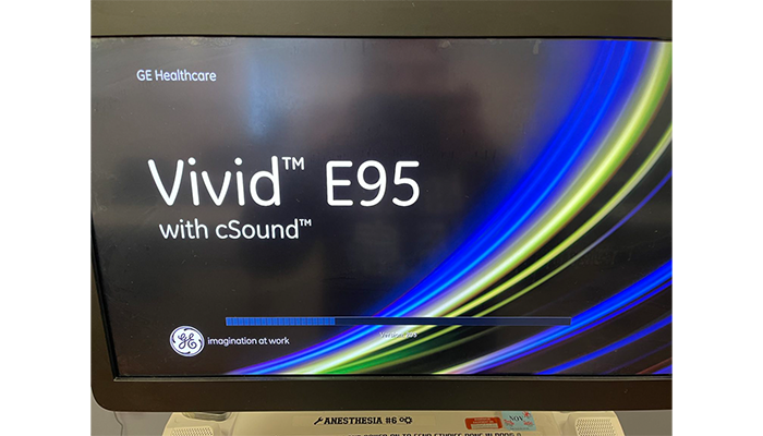 GE Vivid E95
