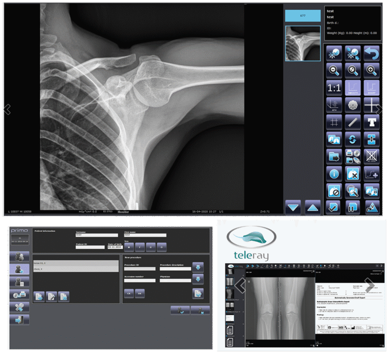 Summit AMRAD Primo DR Panel and Software