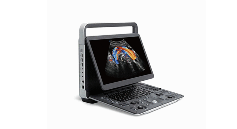 Sonoscape E2 Portable Ultrasound Machine