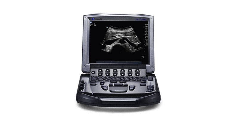 Sonosite M-Turbo Portable Ultrasound Machine